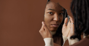 découvrez des conseils efficaces pour comprendre et traiter l'acné. explorez nos articles sur les causes, les traitements et les astuces pour avoir une peau saine et radieuse.