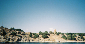 découvrez tout sur la photosensibilité : causes, symptômes et conseils pour gérer cette condition qui rend la peau sensible à la lumière. informez-vous sur les précautions à prendre et les traitements disponibles pour protéger votre peau.